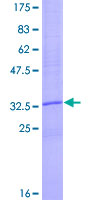 12.5% SDS-PAGE Stained with Coomassie Blue.